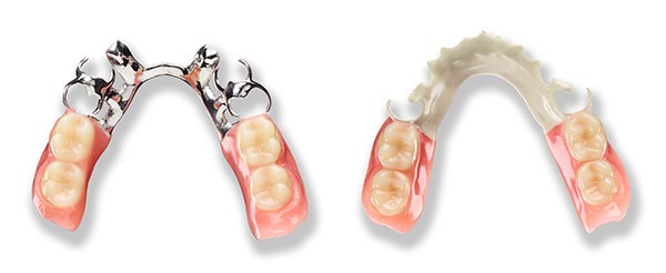 Nhs Dentures Oxford ME 4270